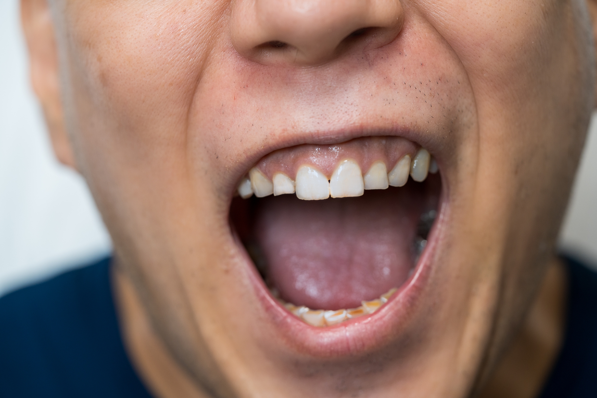 大きく口を開ける男性